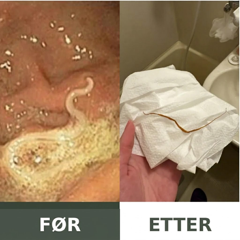 Detox-sett med lakserolje
